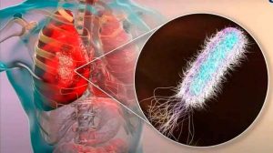 En operación la primera Unidad de Diagnóstico de Enfermedades Raras en México En operación la primera Unidad de Diagnóstico de Enfermedades Raras en México