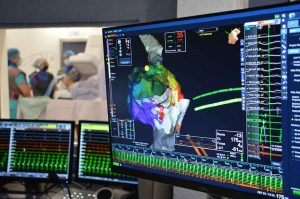 SSG realiza reconstrucción tridimensional de un corazón con dos arritmias cardiacas SSG realiza reconstrucción tridimensional de un corazón con dos arritmias cardiacas