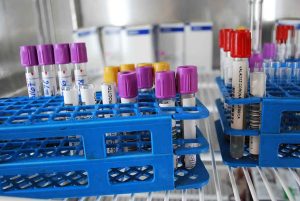 SSG genera 14 mil 759 unidades de sangre en lo que va del año SSG genera 14 mil 759 unidades de sangre en lo que va del año