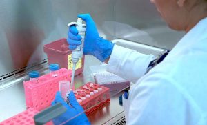 SSG mantiene bajo observación epidemiológica a la enfermedad de Meningitis tuberculosa Meningitis tuberculosa