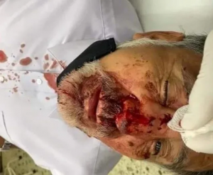 Salvaje golpiza al sacerdote Mateo Calvillo Paz en Queréndaro, Michoacán Salvaje golpiza al sacerdote Mateo Calvillo Paz en Queréndaro, Michoacán