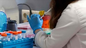 Rusia confirma su primer caso de viruela del mono Rusia confirma su primer caso de viruela del mono