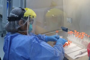 Gto con 28 casos sospechosos de viruela del mono, 19 ya fueron descartados y tres más en espera de resultados. Gto con 28 casos sospechosos de viruela del mono, 19 ya fueron descartados y tres más en espera de resultados.