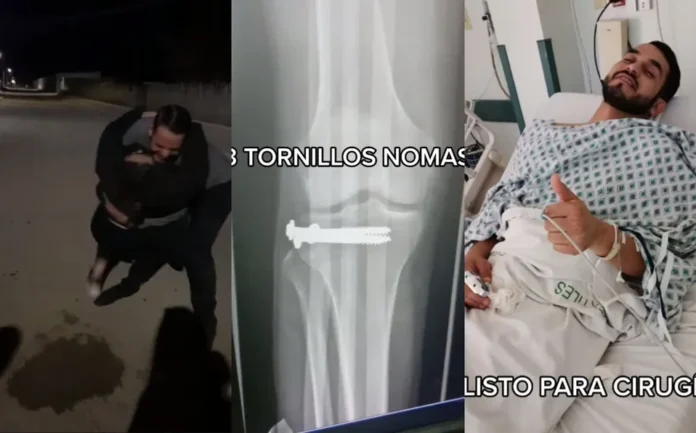 hombre-fractura-pierna-video-vuelve