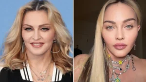 Madonna habla de su cirugía Madonna habla de su cirugía
