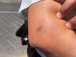 Por no dejarse sobornar es golpeado por un grupo de hombres Por no dejarse sobornar es golpeado por un grupo de hombres