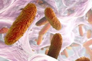 Detectan bacteria Klebsiella oxytoca en seis bebés de Guanajuato; uno de ellos murió Detectan bacteria Klebsiella oxytoca en seis bebés de Guanajuato; uno de ellos murió